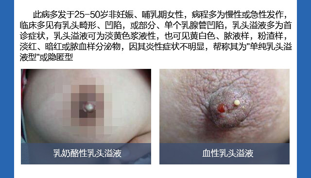 ������ (��ͷ��Һ��)