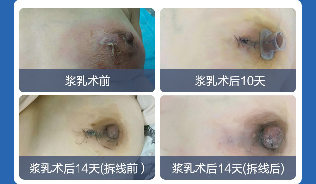 ��ǧ�������������ǻ�����Ч�õĳ�ŵ