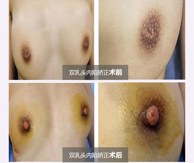 ����������Ч���Ա�